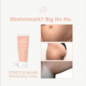 Stretch Mark Minimizing Cream (100g)